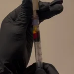 PRP Joint injections