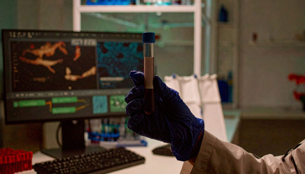 Gloved hand holding a blood sample in a modern medical lab, with digital monitors in the background.