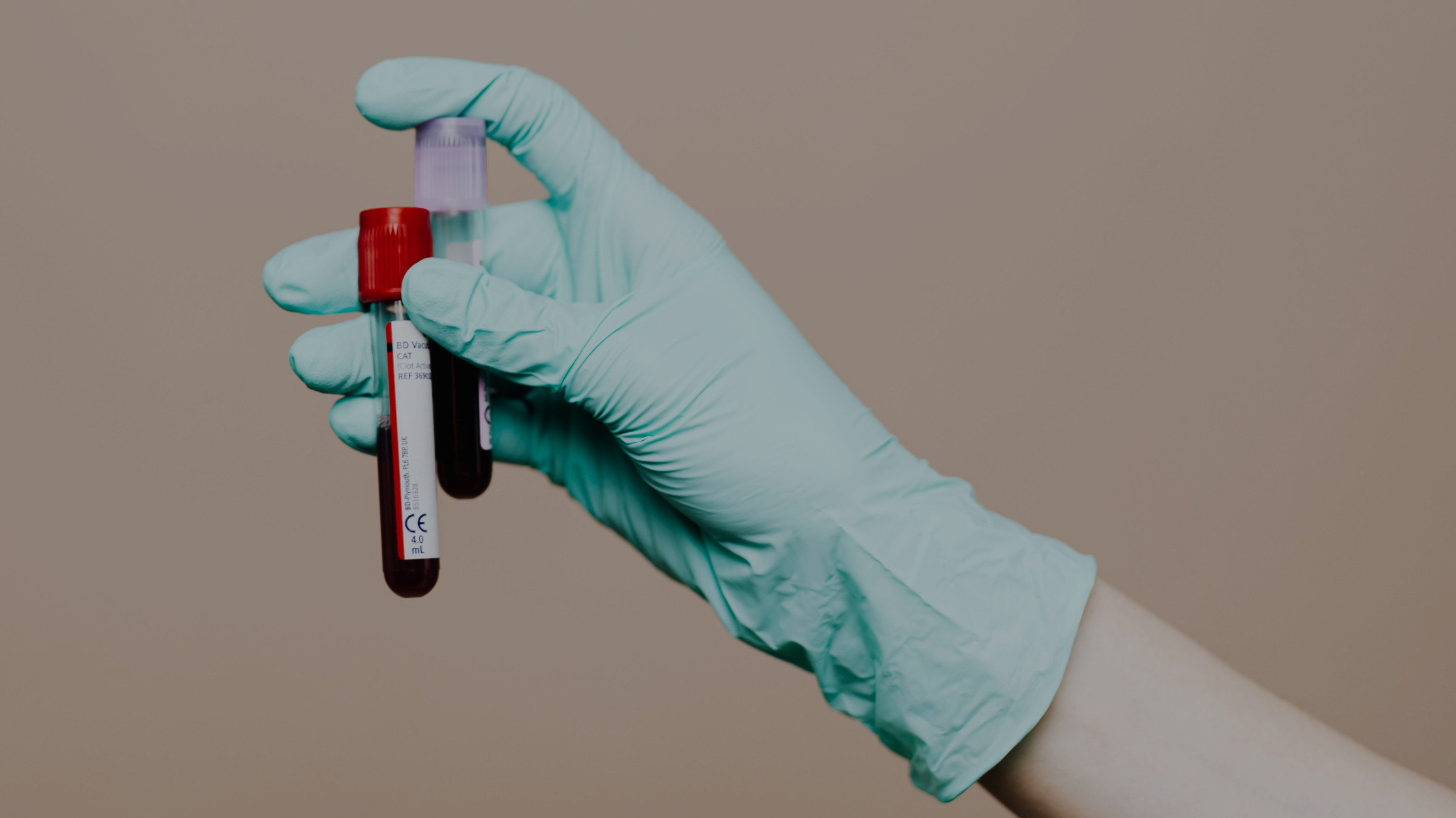 Top 5 Blood Tests Everyone Over 40 Should Get (and Why)
