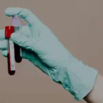 Top 5 Blood Tests Everyone Over 40 Should Get (and Why)