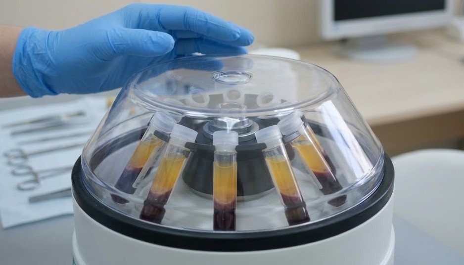 What Is a PRP Vampire Facial